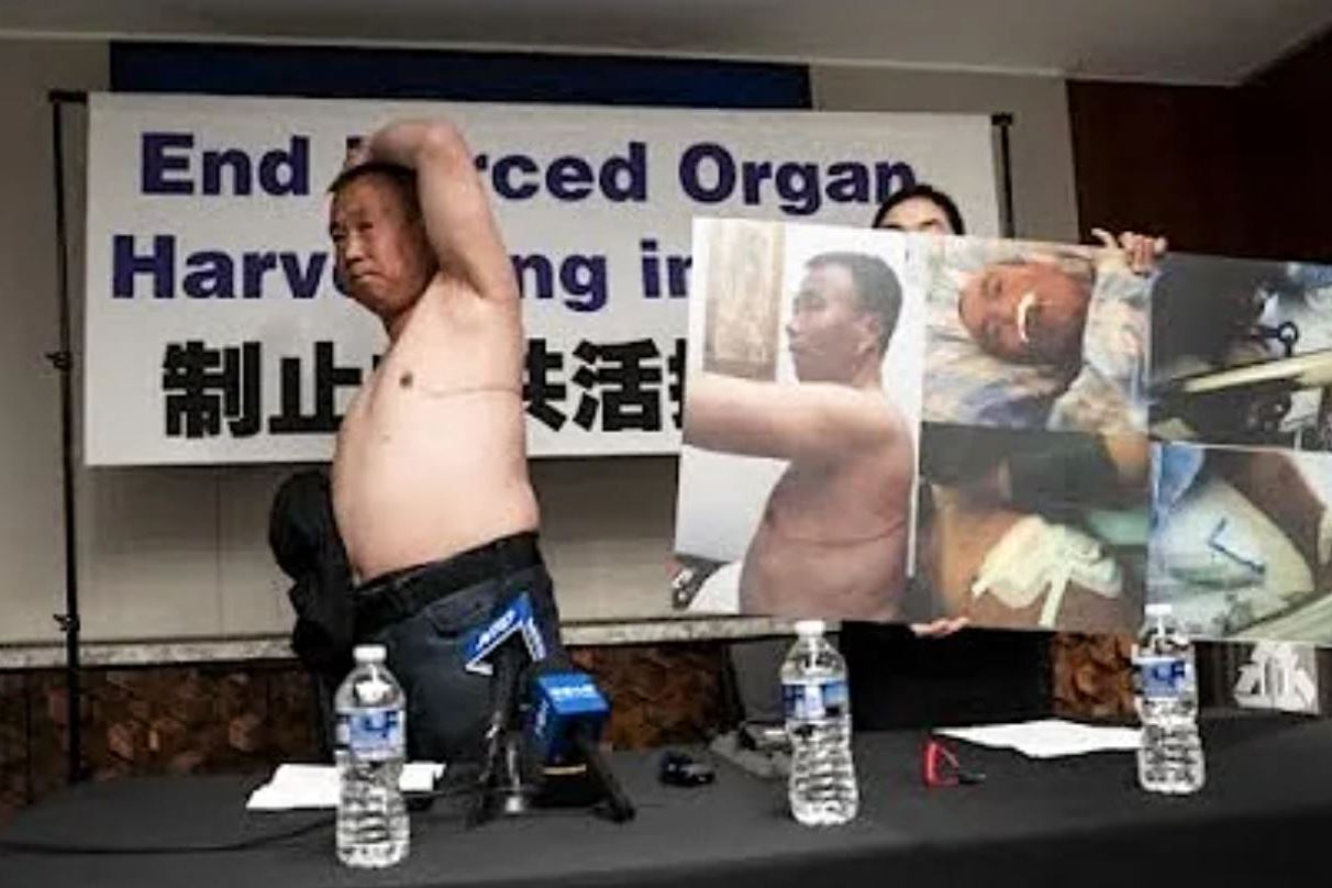 Image for article Media Outlets Report on How the CCP Forcibly Harvested Organs from Falun Gong Practitioner Cheng Peiming (Part 2)